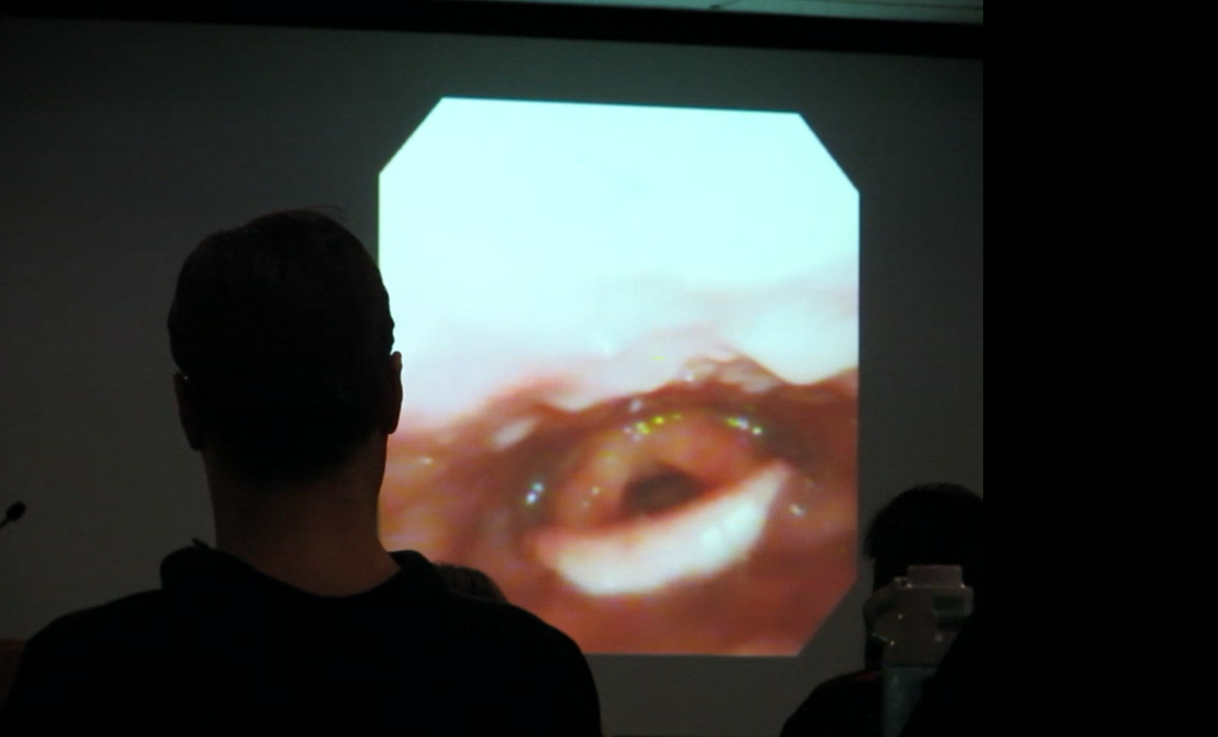 A FEES examination projected on screen during a Langmore FEES course lecture